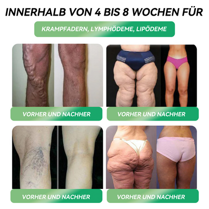 𝐇𝗛𝑉𝖡® 🇩🇪 6-in-1-𝐆𝗟𝑷-1-Gesundheitsformel 🌿🌿, 𝐟𝐥ü𝐬𝐬𝐢𝐠 𝐳𝐮𝐦 𝐄𝐢𝐧𝐧𝐞𝐡𝐦𝐞𝐧 (Nur eine Dosis pro Tag, sichtbare Veränderungen in 7 Tagen) ✅ Für Fettleibigkeit, kardiovaskuläre Gesundheit, Diabetes, Schlafapnoe, Gelenkprobleme und mehr.